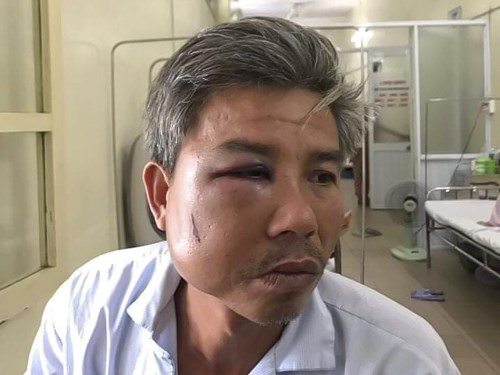 Thừa Thiên - Huế: Khởi tố chủ quán “Bố Già” đánh nhân viên công ty cây xanh
